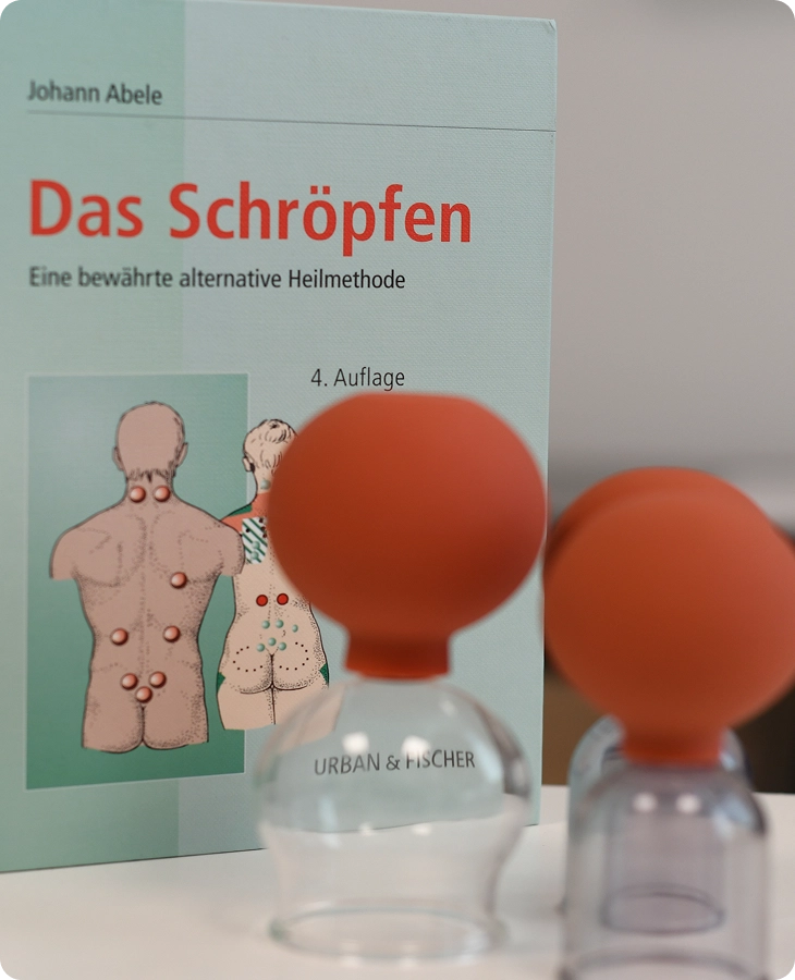 lehrbuch über das schröpfen und einige schröpfgeräte im vordergrund
